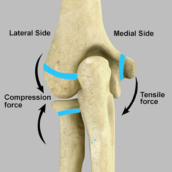 Elbow Pain in the Young Athlete