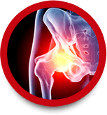 Joint Replacement